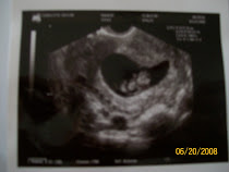 baby j #4