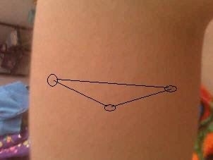 triangle-shaped-freckle