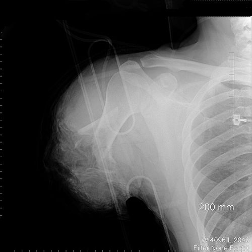[48254272c58d1xray002.jpg]