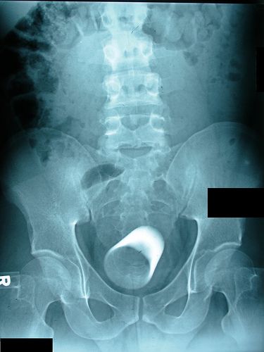 [4825427e60e43xray012.jpg]