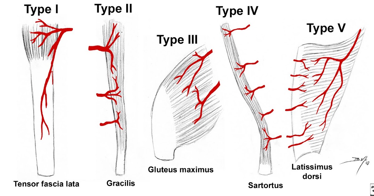 MEDICAL Flap Surgery