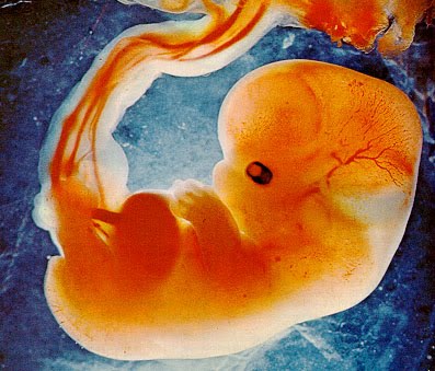 [fetus.jpg]