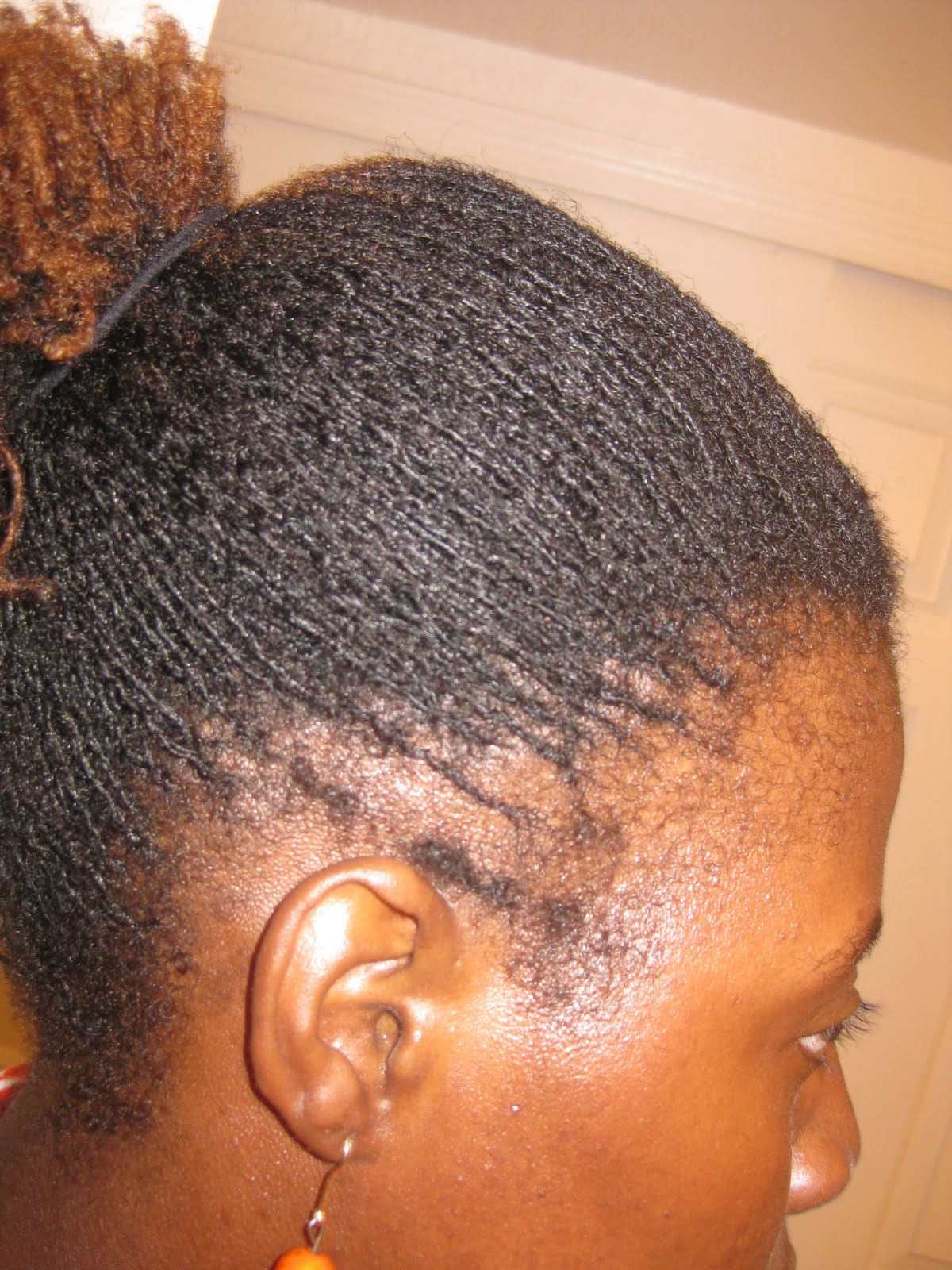 Kreyola's Journeys Improvement Growth of Frontal Side Hairs & Locking