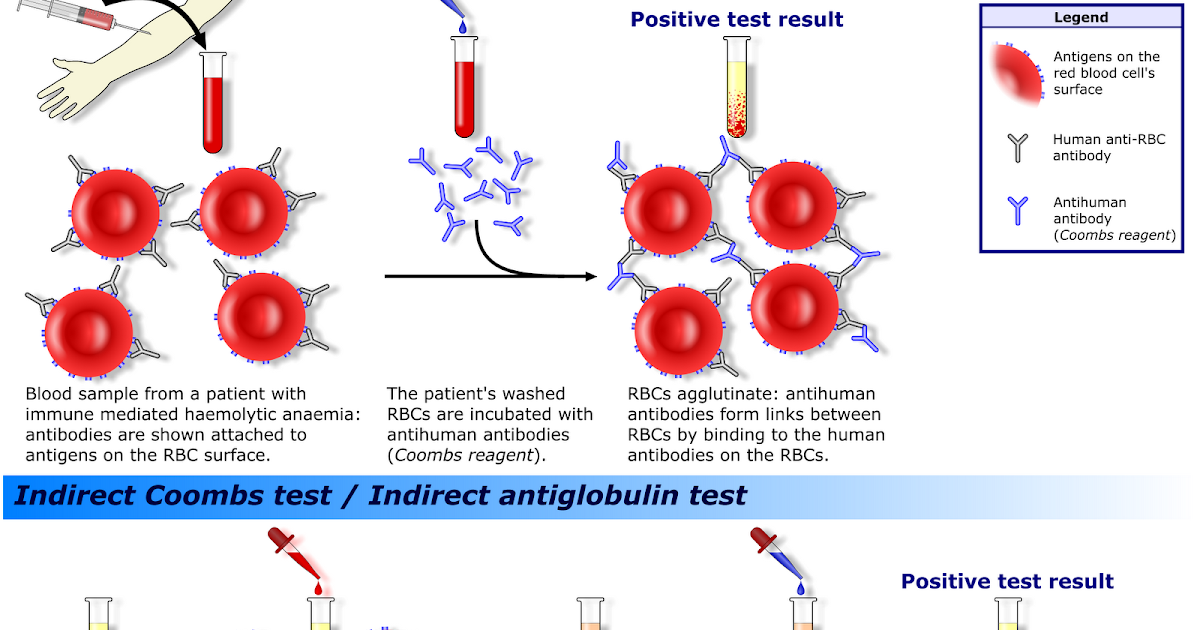 IMDOC Coomb's test!