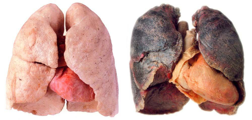 what happens when you smoke. what happens when you smoke.