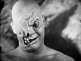 The Cyclops