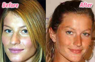 stars_plastic_surgery_08.jpg