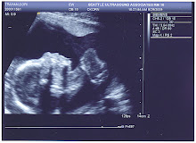 Baby Trahan 20 Weeks