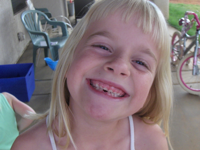 [Hallie_first_lost_tooth_Sep07.jpg]
