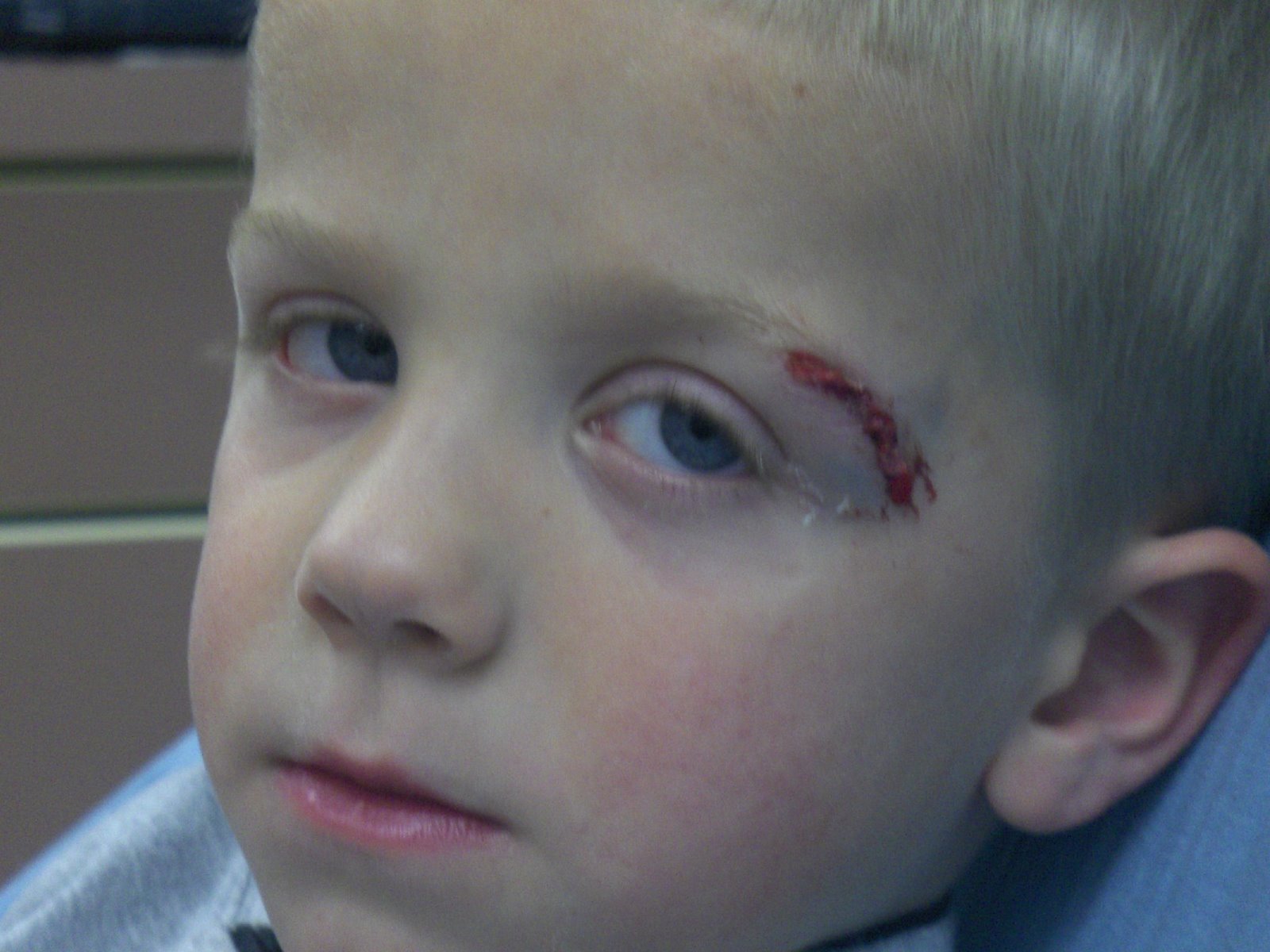 [Ben_cut_hospital_closeup.JPG]