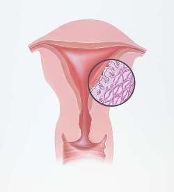 [dysmenorrhea.JPG]