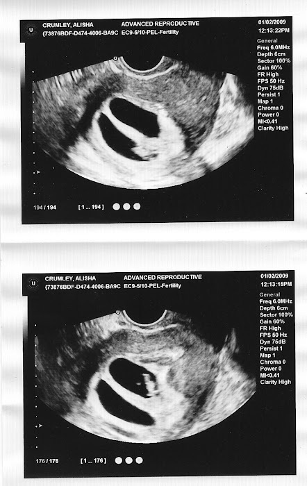 Twins at 7 weeks