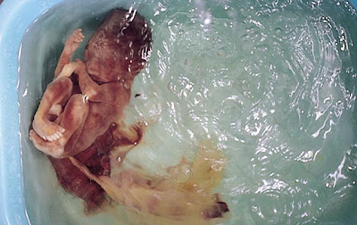 Chinese eat Baby Soak a Infant Body in water