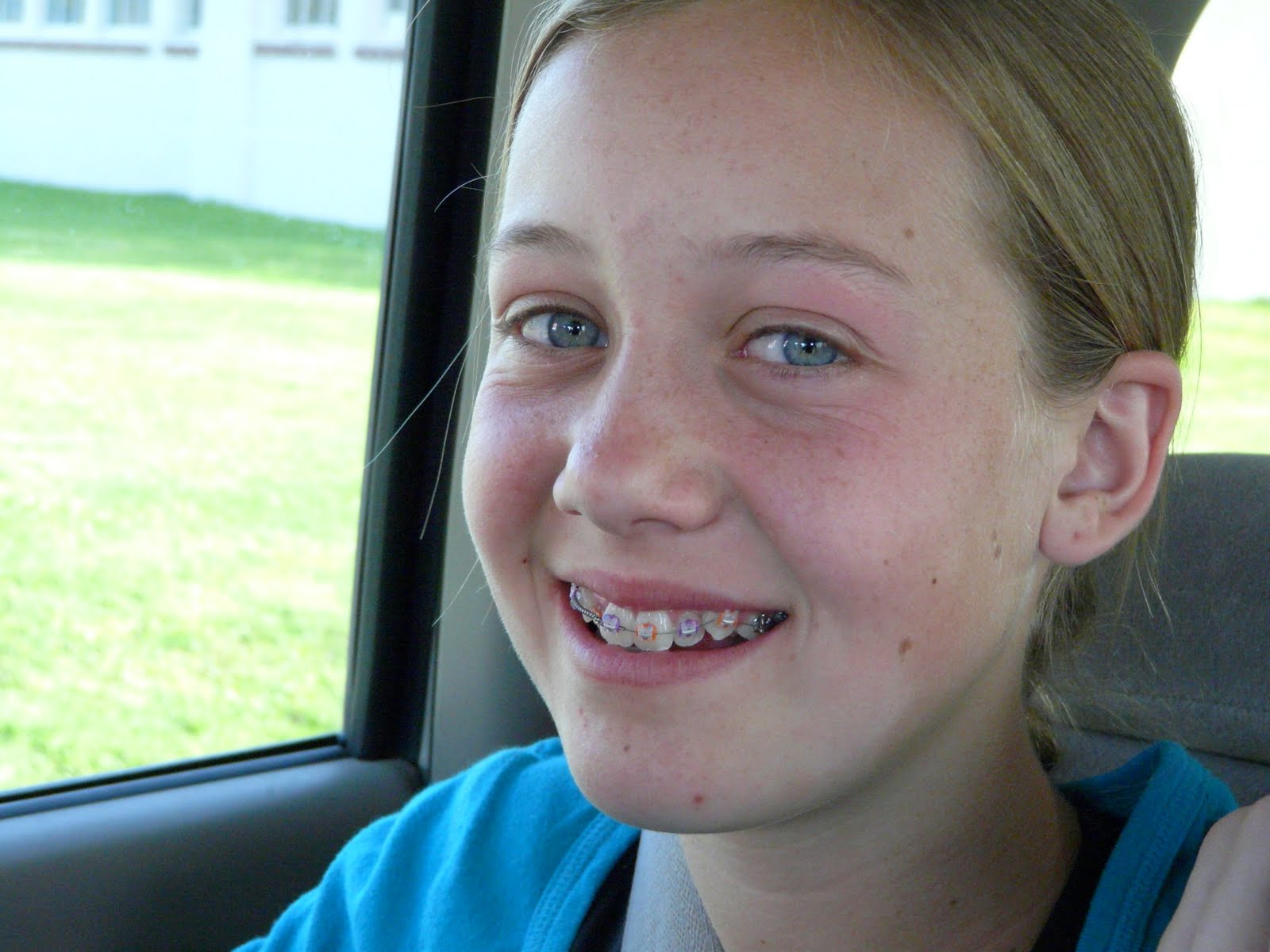 Mom On A Mission Charsie Has Braces