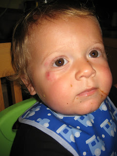 Kids With Rabies