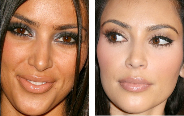 Plastic Surgery We Nose Its Fake Doll