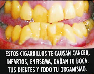 Como a dejar fumar penosamente