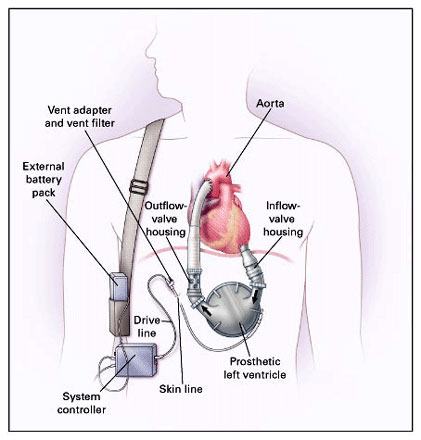 Free Lite
Brite Pattern, Lite Brite Patterns To Download