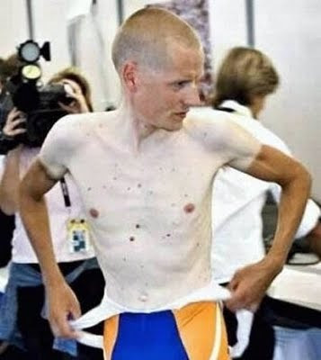 worst tanning disasters