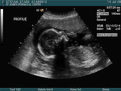 Isabelle at 20 weeks