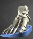 [__-_wedge.JPG]
