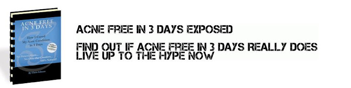 Acne Free In 3 Days