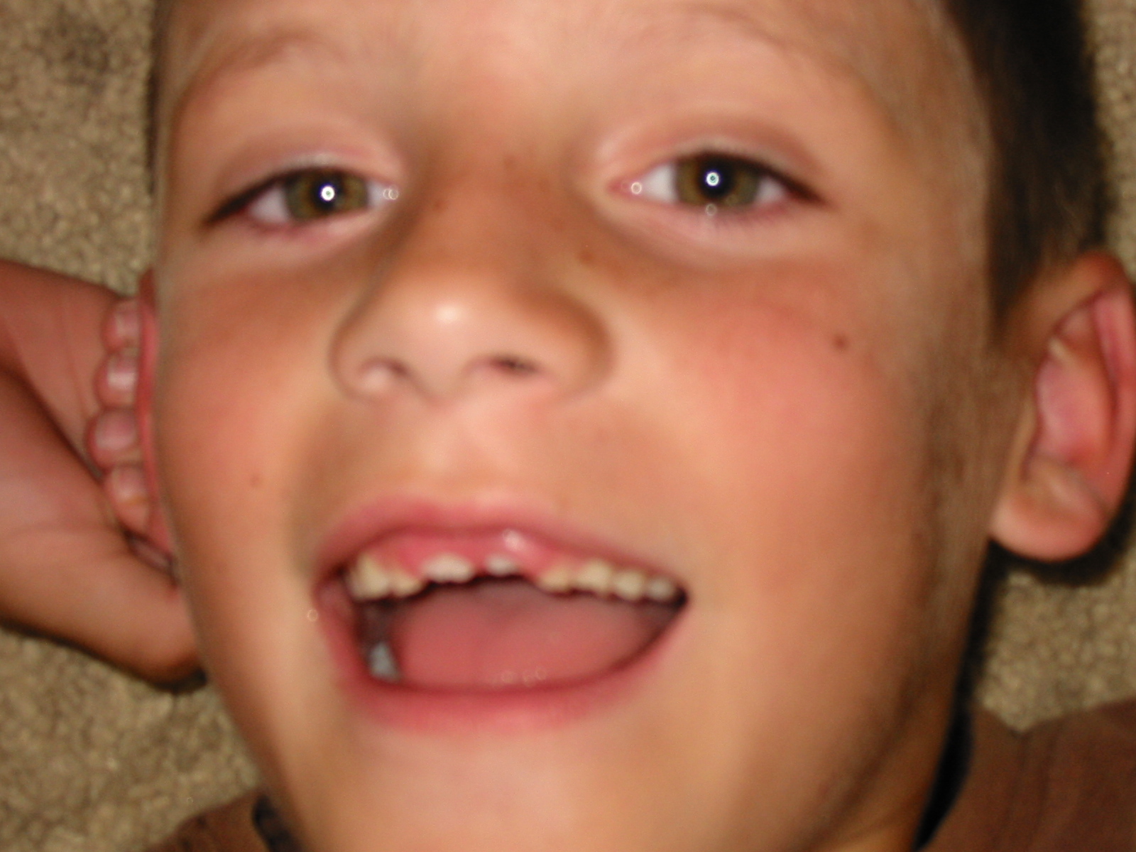 nubby teeth
