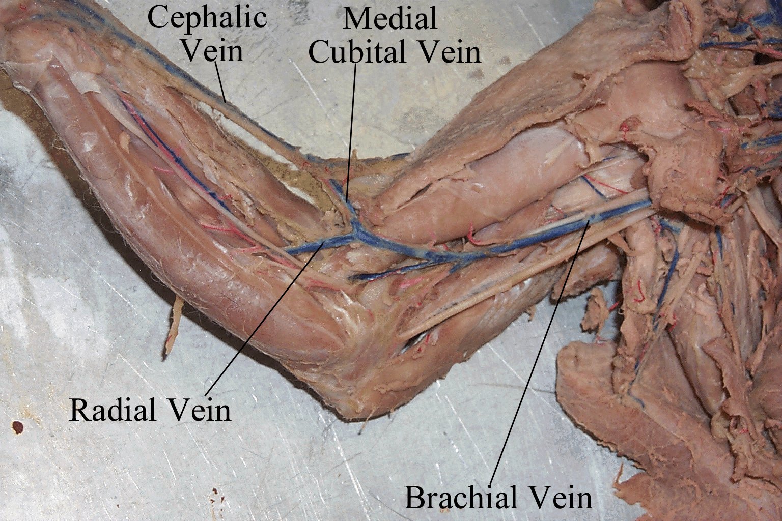 Arm+Veins+Diagram Don't be such a baby, I'll change your diaper, OK?: Anatomy, Fibonacci ...