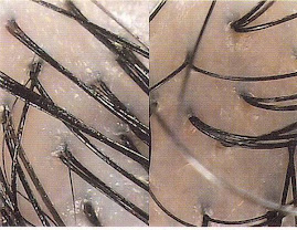Scalp Analysis