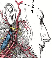 Dev hücreli arterit Hastalığı