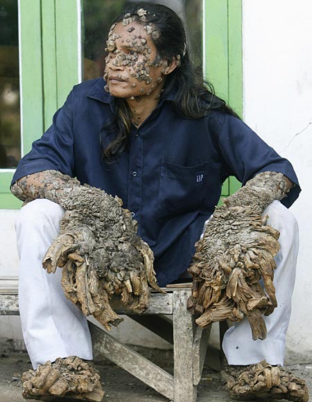 tree man feet. tree man feet.