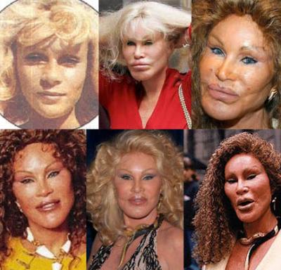 [Jocelyn_Wildenstein.jpg]