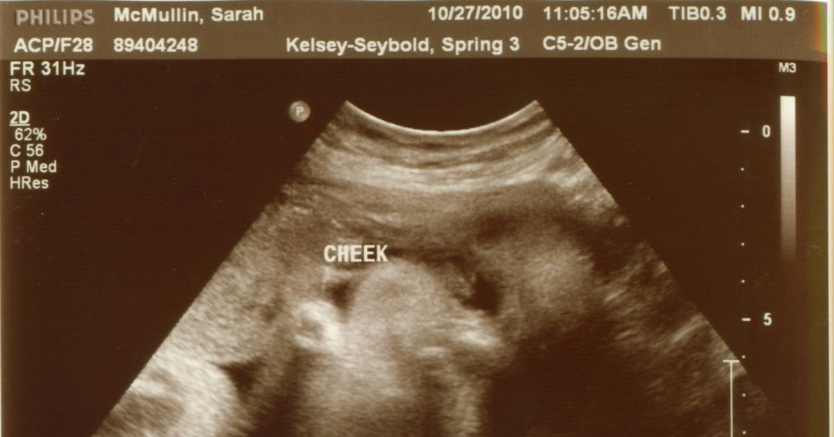 The Cadburies Baby Skeleton Face