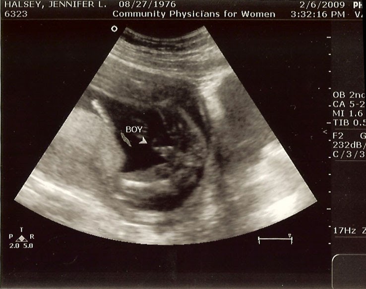 The Great Adventure of Sanders Baby Ultrasound. It's a.. (keep