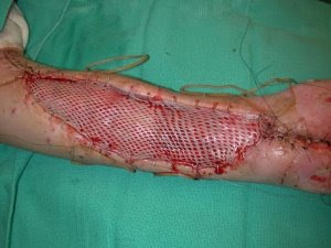 Can Dogs Survive Rattlesnake Bites Can Dogs Survive Rattlesnake Bites