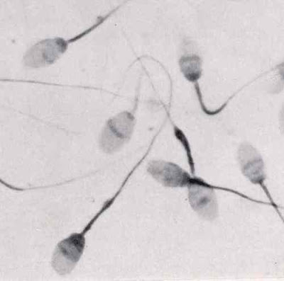 கோடி உயிரில் ஒரு உயிர் - வித்தியாசமான புகைப்படம் Sperm+Cells+%285%29