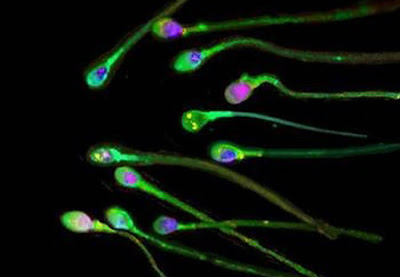 கோடி உயிரில் ஒரு உயிர் - வித்தியாசமான புகைப்படம் Sperm+Cells+%282%29