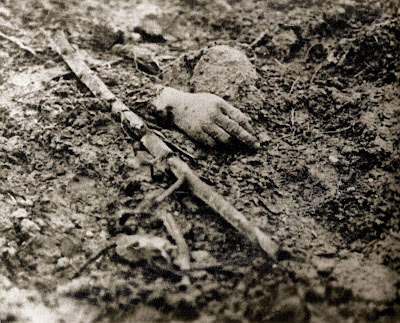 Ww1 Dead