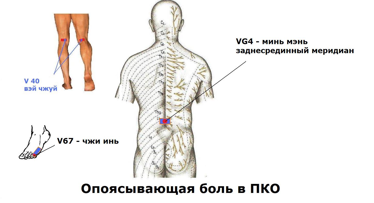 Если опоясывающая боль в пояснице Если опоясывающая боль в пояснице