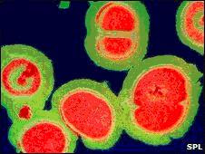 நோபல் விஞ்ஞானி வெங்கட்ராமன் ராமகிருஷ்ணனும் ரிபோசோம்களும் Bacteria+ribosome