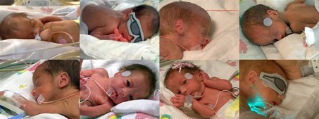 [large_CAoctuplets.jpg]