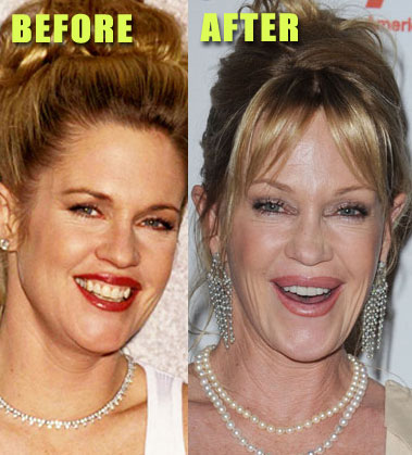 Melanie Griffith - did she get ...