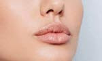 collageninjectionslips