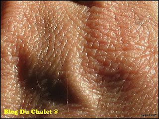 Un zoom sur une peau humaine épaisse de teint moyen.