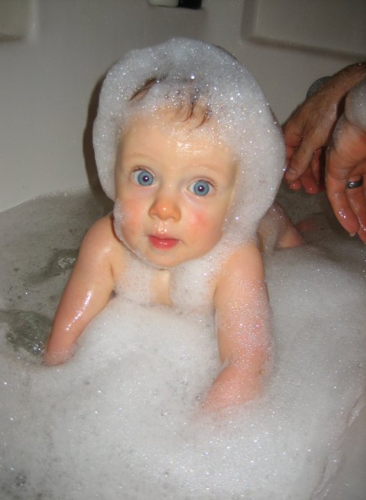 newborn heat rash on face. heat rash on arms. newborn heat rash on face.