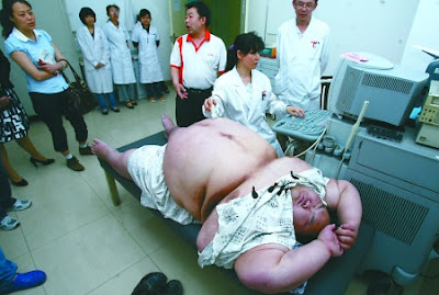 அதிக எடை கொண்ட குண்டு மனிதருக்குபரிசோதனை செய்ய டாக்டர்கள் திணறல் China+fat