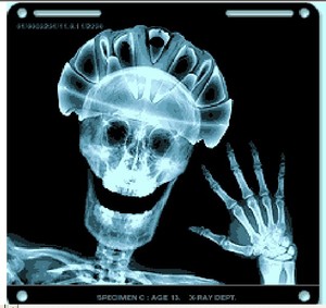 [xray.jpg]