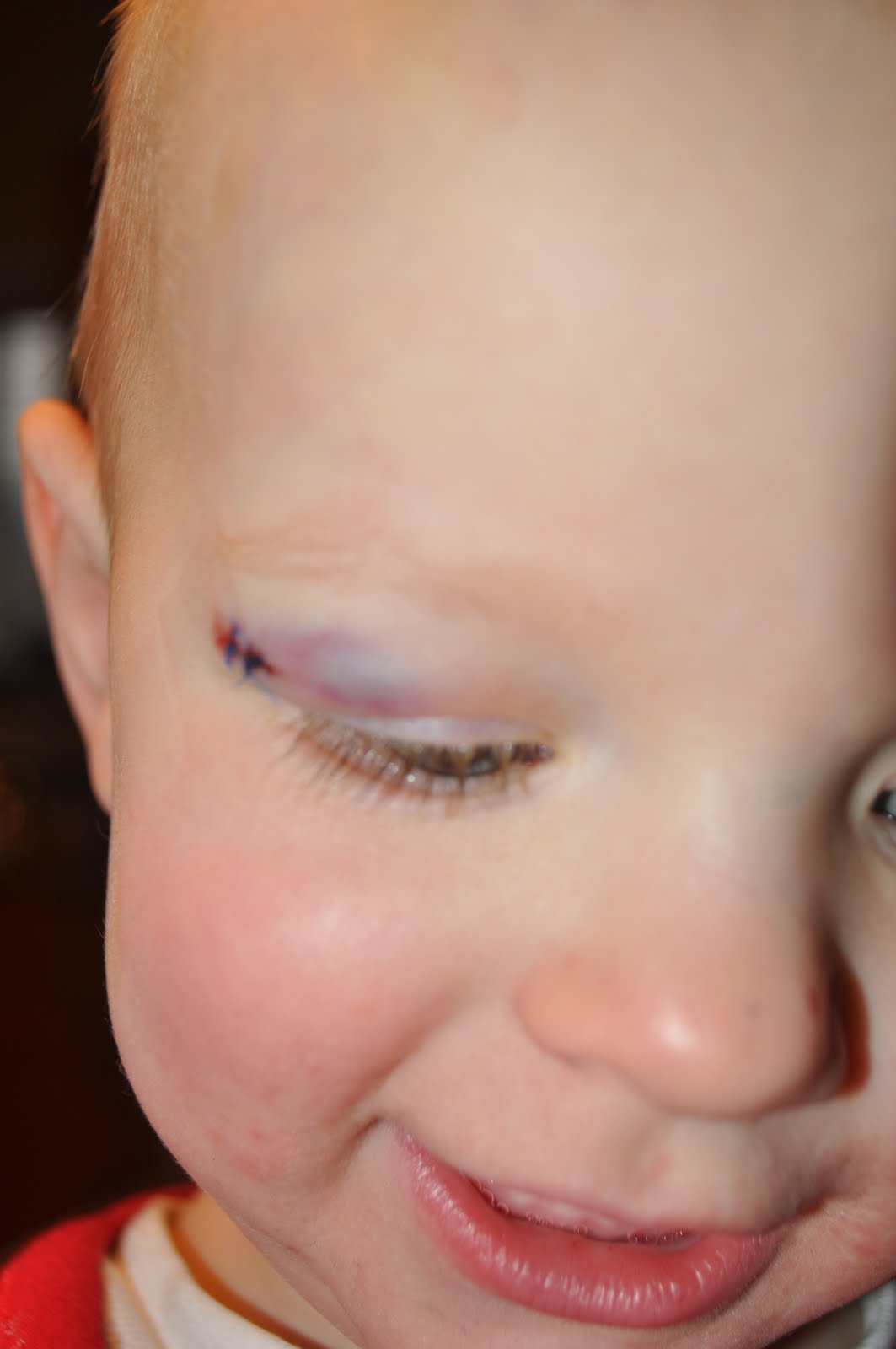 The Poulsen Family Baby hurt...