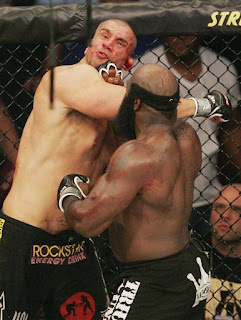 James Thompson's cauliflower ear