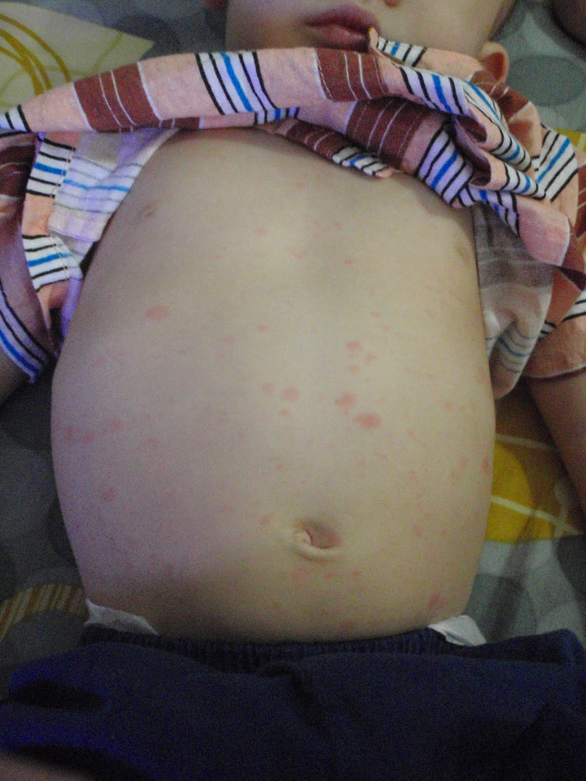 All about babies and kids 3DayFever The 1st severe viral infection